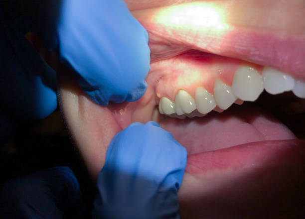 Best Urgent Care for Lost Fillings or Crowns in Jonesboro, AR