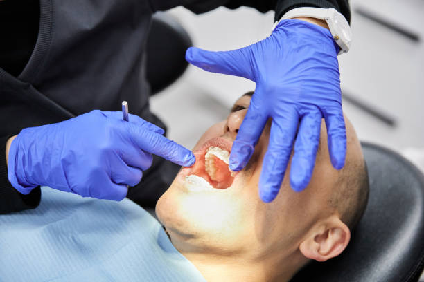 Best Emergency Dental Care for Broken or Chipped Teeth in Jonesboro, AR